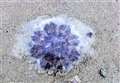 Huge numbers of stinging jellyfish hit north beaches