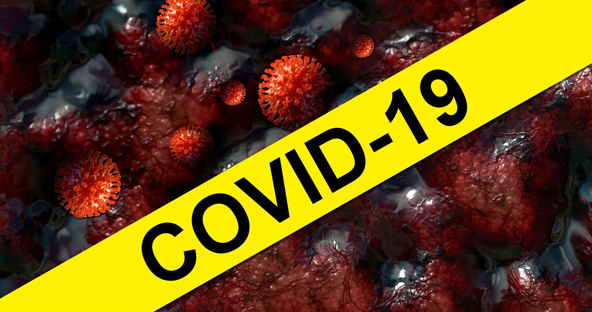 Covid-19 update.